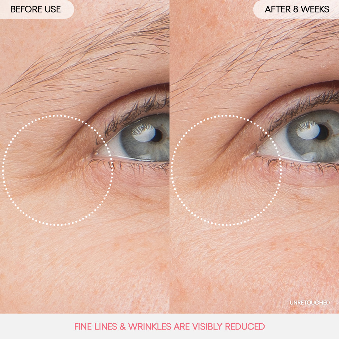 Bouncy & Firm Eye Sleeping Mask - Image 3